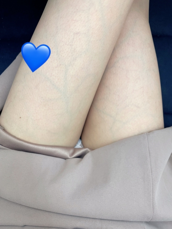 1枚目